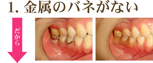 金属のバネがない