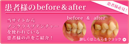 患者様のbefore＆after